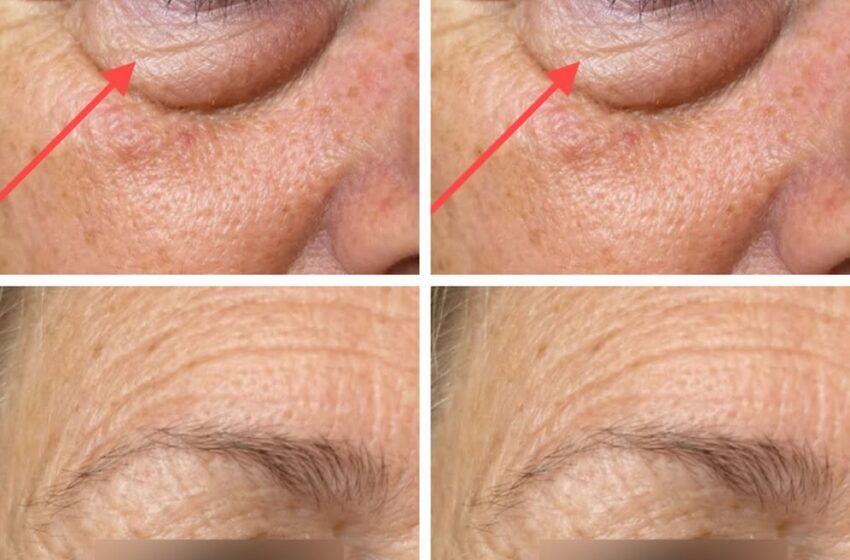  These are the first symptoms of a…