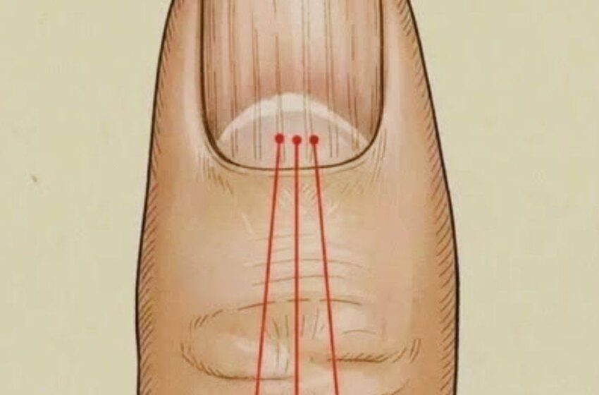  What to Eat to Reduce Nail Ridges: A Nutrition Guide for Healthier Nails