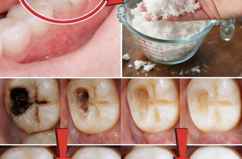  Smart Habits to Protect Your Teeth