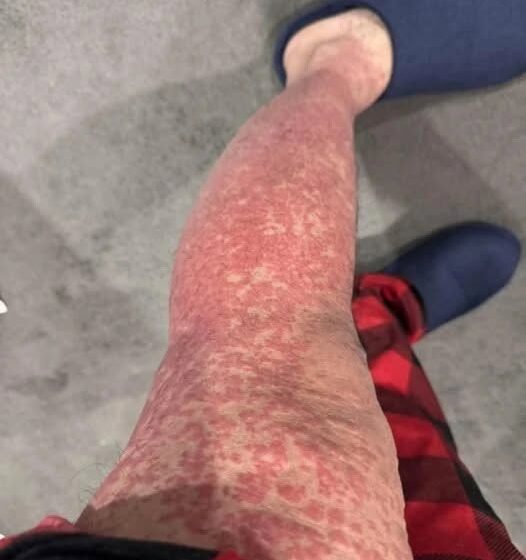  Here are the consequences of sleeping with… See more