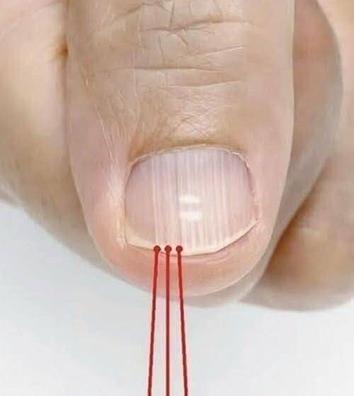  If you have these lines on your nails after 40, it is a clear sign that..