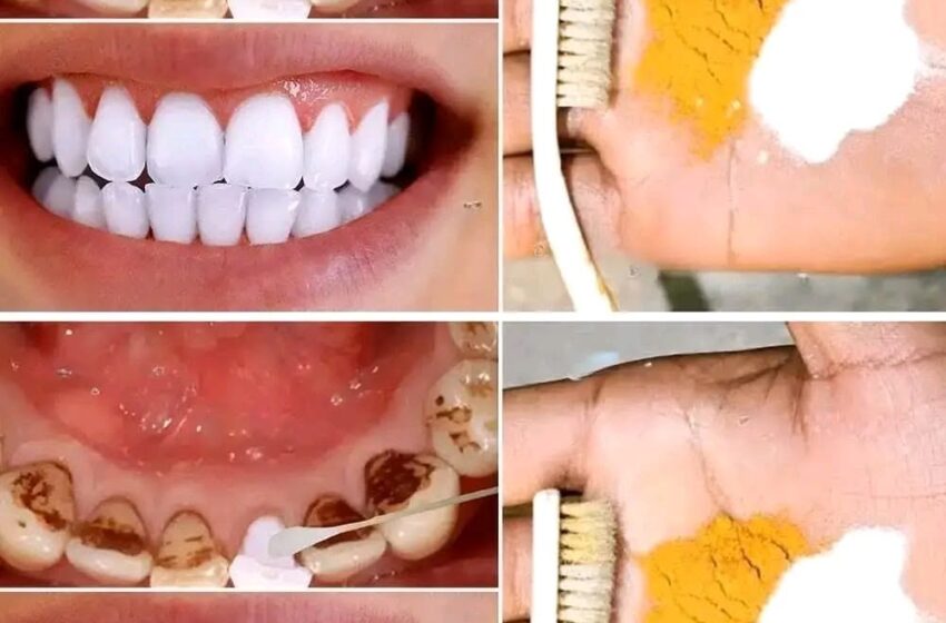  Home Teeth Whitening: Get Whiter Teeth in Just 2 Minutes!