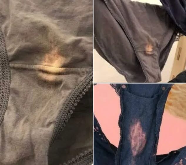  If you find a “bleach” patch on your underwear, here’s what it means